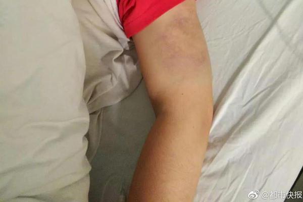 新業(yè)態(tài)疊加新鏈路 浙江民企“出?！泵? /></a>
                        <span id=